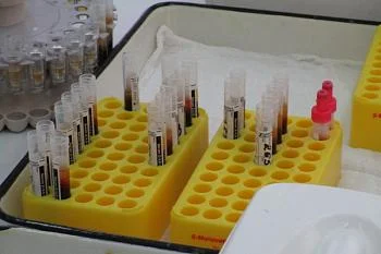 Вниманию пациенток, вставших на очередь на ЭКО! Вниманию пациенток, вставших на очередь на ЭКО!